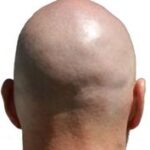 Profielfoto